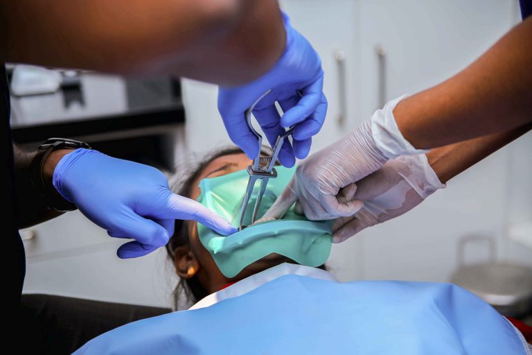 Root canal Treatment in coimbatore