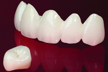 crown dental care