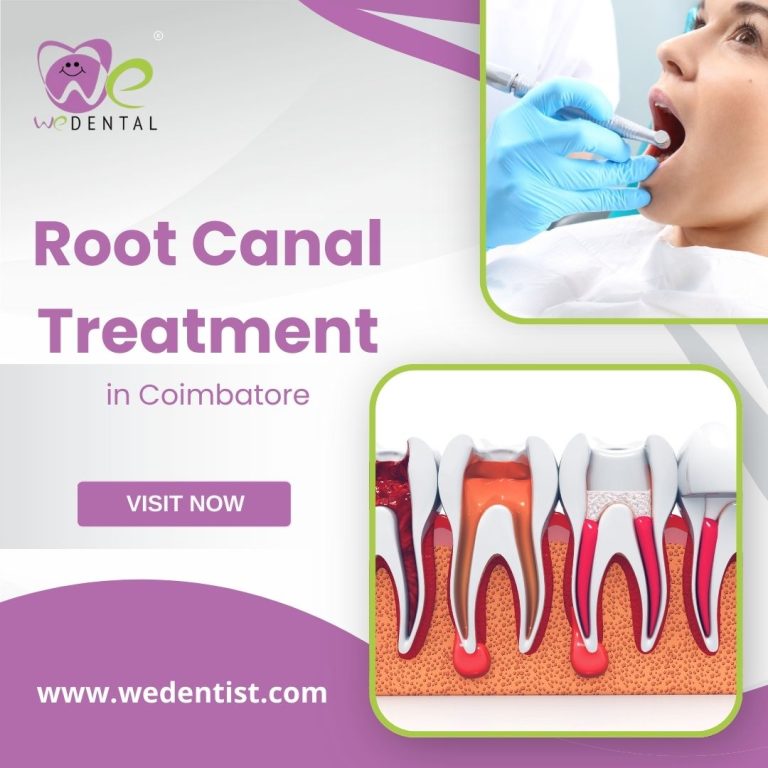 Root Canal Treatment